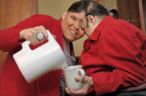 illustration-conjoined-twins